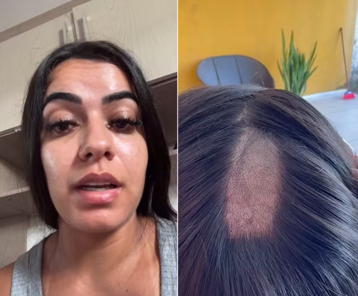 Exame toxicológico para CNH gera polêmica após jovem ter cabelo raspado durante coleta